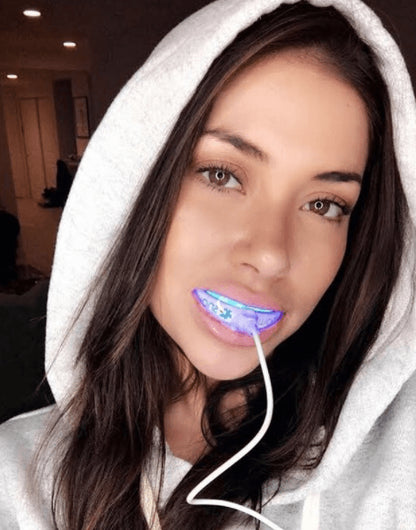 At-Home Teeth Whitener - Bck OFFICIAL All-in-One SNOW Teeth Whitening™ System [SALE]