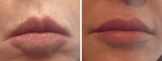 All-New Anti-Aging Lip Treatment with Resveratrol