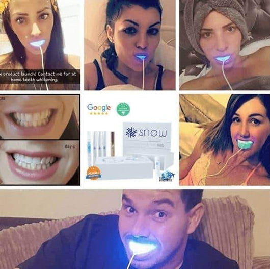 At-Home Teeth Whitener - Bck OFFICIAL All-in-One SNOW Teeth Whitening™ System [SALE]