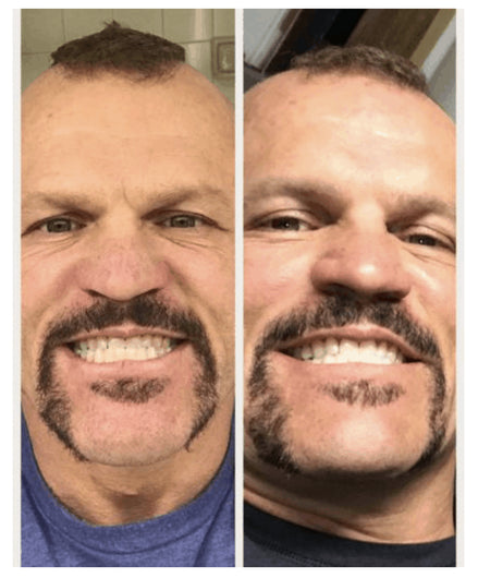 President's Day Exclusive Bundle