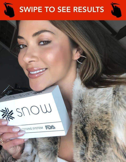 At-Home Teeth Whitener - Bck OFFICIAL All-in-One SNOW Teeth Whitening™ System [SALE]