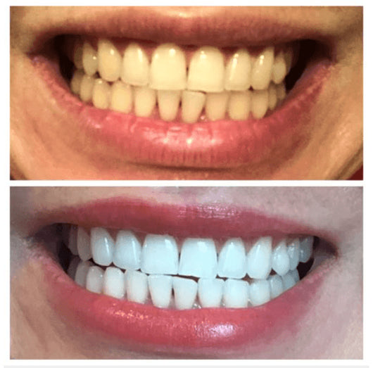 FIONA PRICE DIFFERENCE