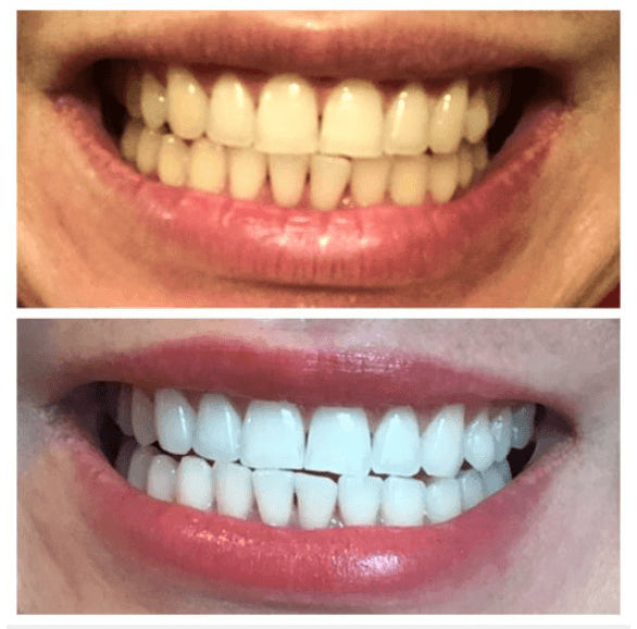 FIONA PRICE DIFFERENCE