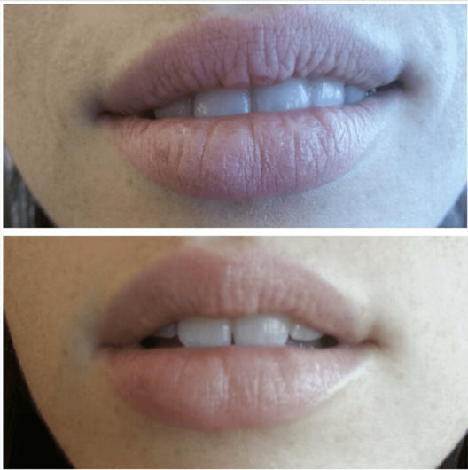 All-New Anti-Aging Lip Treatment with Resveratrol