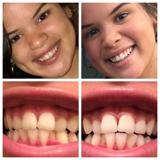 Holiday Gift Bundle (Save $188)