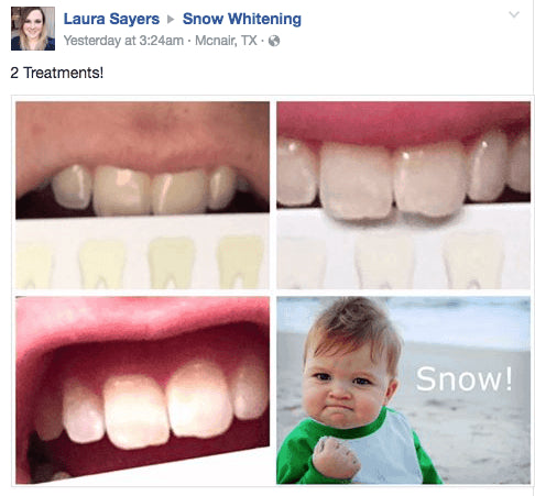 At-Home Teeth Whitener - Bck OFFICIAL All-in-One SNOW Teeth Whitening™ System [SALE]