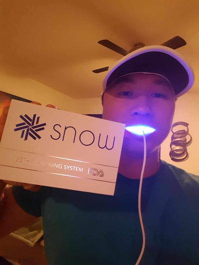 At-Home Teeth Whitener - Bck OFFICIAL All-in-One SNOW Teeth Whitening™ System [SALE]