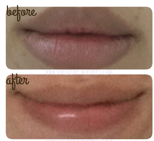 All-New Anti-Aging Lip Treatment with Resveratrol